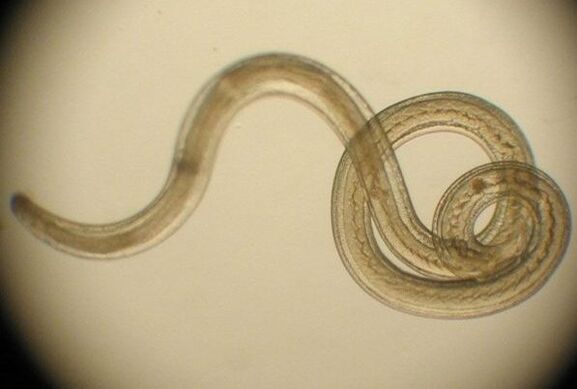 worm parasite from the human body