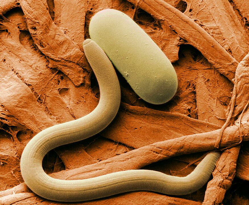 Parasite under a microscope