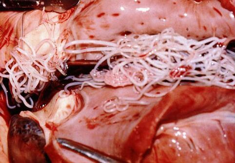 Parasites in the human body