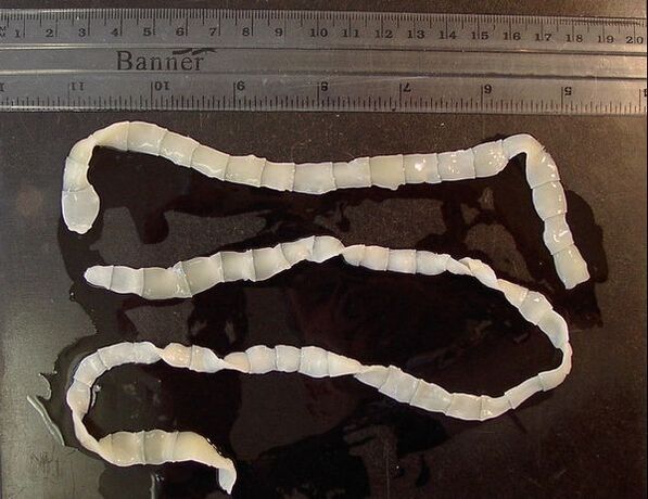 wide tapeworm from the human body