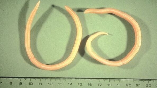 Roundworms are worms that manifest themselves as fatigue and coughing.