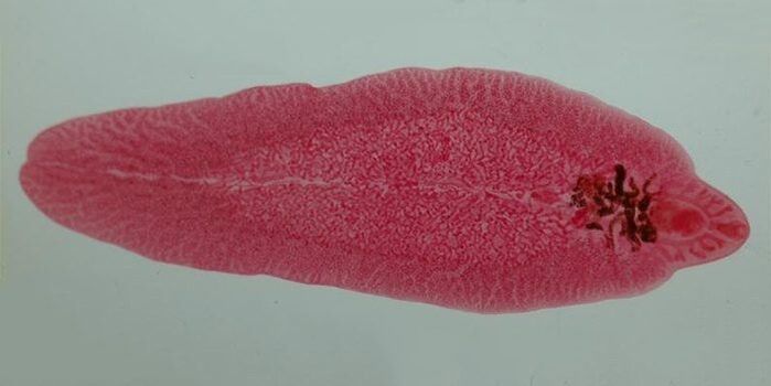 fluke worm in humans