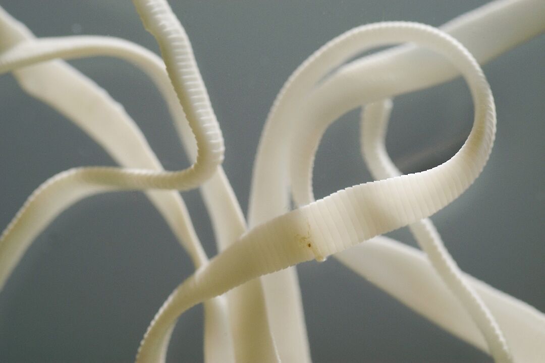 human roundworm worm
