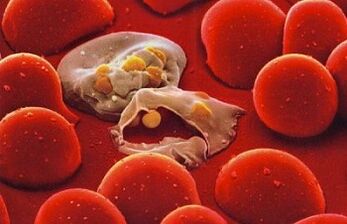malaria plasmodium in the human body