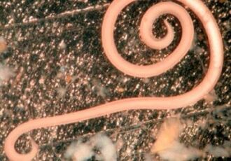 roundworm in the human body