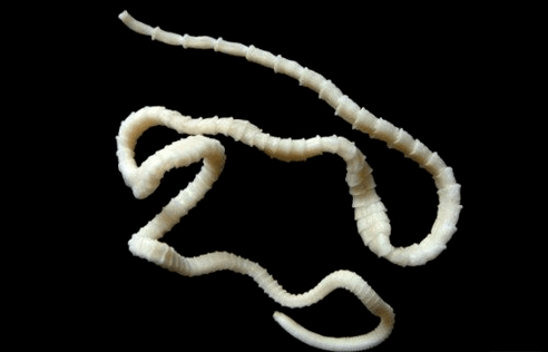 what does bovine tapeworm look like in the human body