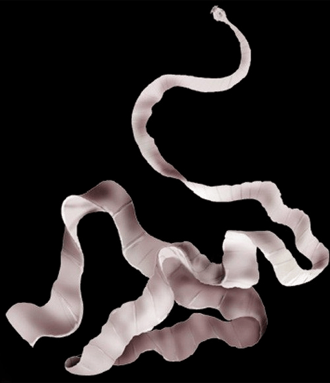 what does pork tapeworm look like in the human body