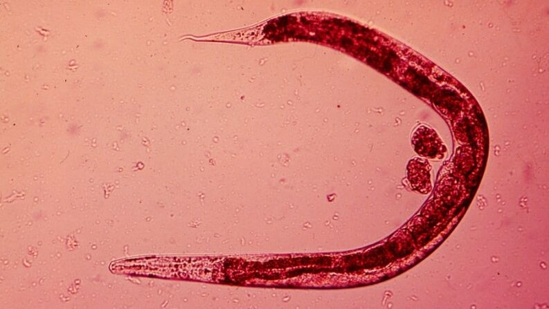 helminth from the human body